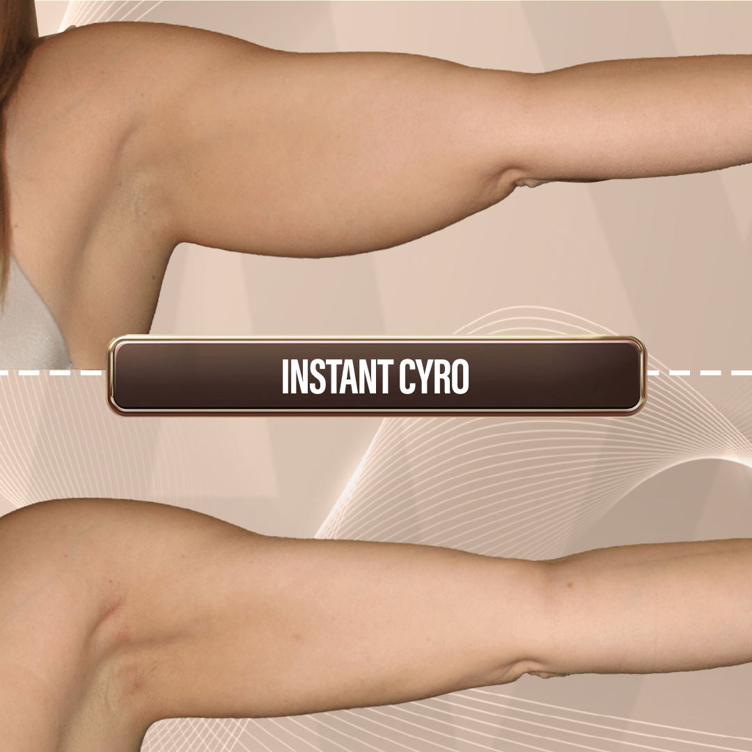 Max Singapore Website Mobile SizeArtboard 1 copy 5